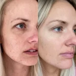 سرم آلفا آربوتین 2 درصد کوزارکسTHE ALPHA arbutin 2% discoloration care serum - Image 2