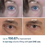 کرم دور چشم ضد چروک و روشن کننده ایفالت دکتر ملاکسین Dr.Melaxin Eyephalt Eyebag Cream - Image 2