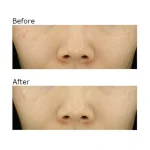 کرم ضد لک جای جوش و روشن کننده یوجا نیاسین سام بای می SOME BY MI Yuja Niacin Anti Blemish Cream - Image 2