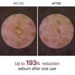 آمپول لایه‌بردار درخشان‌کننده برنج دکتر ملاکسین_Dr.Melaxin Peel Shot Glow Rice Peeling Ampoule - Image 3