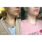 کرم لیفتینگ و ضد چروک گردن مدی پیل_Medi-Peel premium collagen naite thread neck cream 2.0 - Image 4