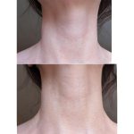 کرم لیفتینگ و ضد چروک گردن مدی پیل_Medi-Peel premium collagen naite thread neck cream 2.0 - Image 5