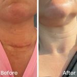 ژل ترمیم کننده جای زخم و بخیه سیکالفیت پلاس اون_avene cicalfate gel cicatrices - Image 2