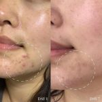 سرم ضد لک و جوش اکسیس وای_ Axis-Y Difference Blemish Treatment - Image 2