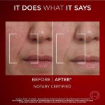 کرم لورال ضدچین و چروک روز رویتالیفت لیزر L'Oréal Revitalift Laser X3 Day Cream - Image 4