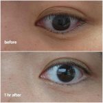 کرم دور چشم دبل ضد تیرگی و ضد چروک قوی دکتر ملاکسین Dr.Melaxin TX Tranexamic Acid Retinalsome Dual Eye Cream - Image 4