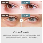کرم دور چشم دبل ضد تیرگی و ضد چروک قوی دکتر ملاکسین Dr.Melaxin TX Tranexamic Acid Retinalsome Dual Eye Cream - Image 3