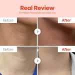 کرم تخصصی لیفت گردن دکتر ملاکسین_DR.MELAXIN NECKLINEPHALT LINE Firming Neck Cream - Image 3