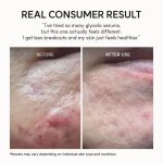 بوستر سرم گلیکولیک اسید آرنسیا لایه‌بردار، کنترل چربی و منافذ و روشن‌کننده پوست_Arencia Eraser Shot Glycolic Acid Booster - Image 3